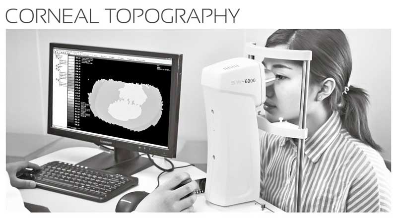 Corneal Topography