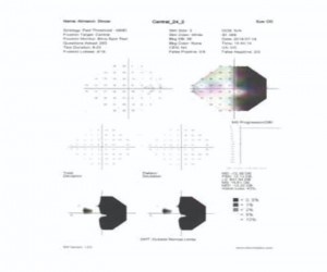 ANALYTICAL INSTRUMENTS