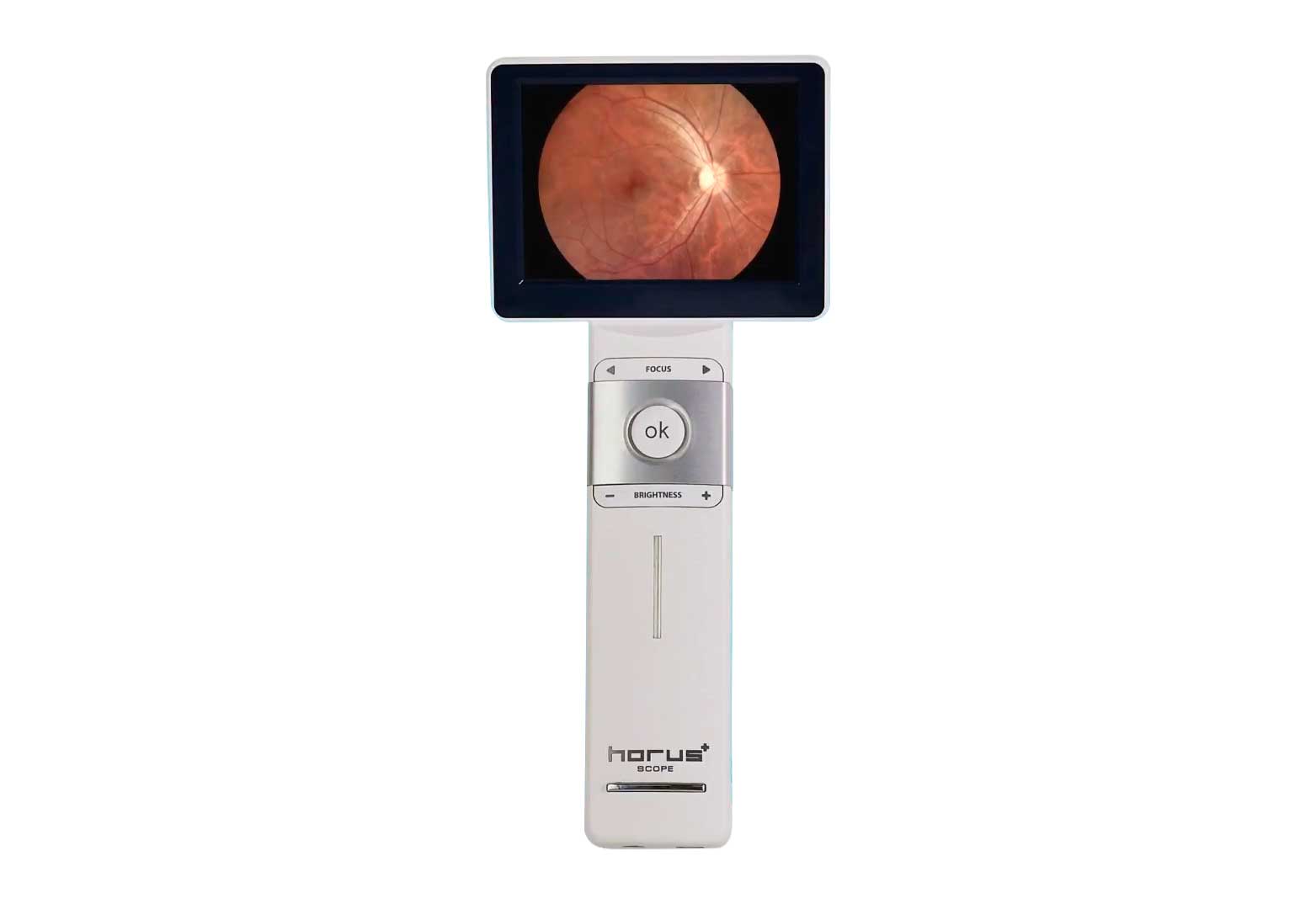 RETINAL CAMERA