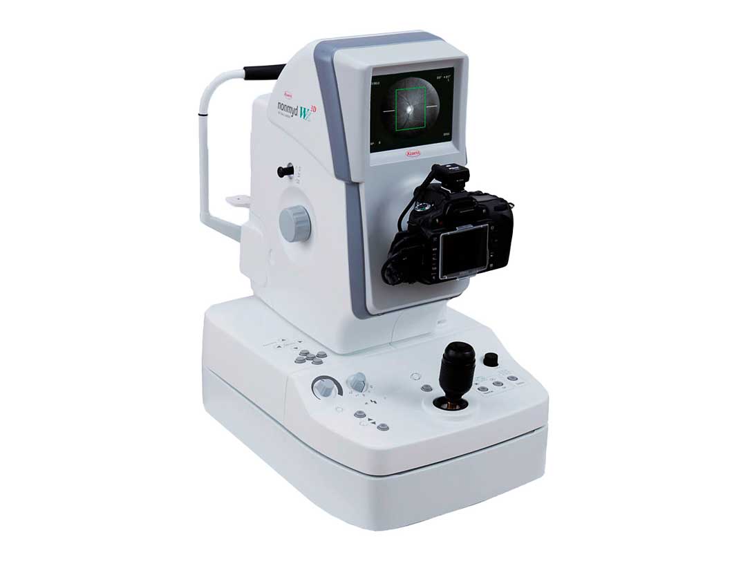 RETINAL CAMERA